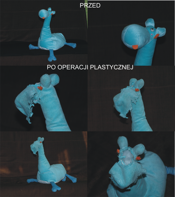 Pierwsza pacjentka do operacji twarzy!